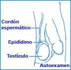 Autoexamen testicular