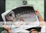 Mujer anoréxica es imagen publicitaria de marca de ropa ita