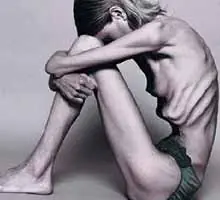 Anorexia... Un camino sin final!