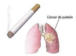 Tabaco y Salud...Algo Para Aprender
