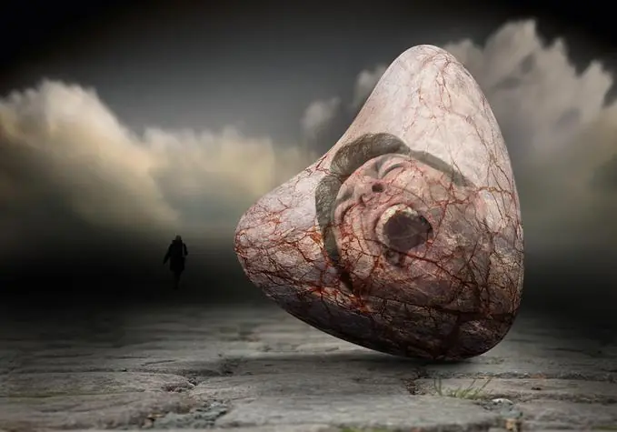 Alteraciones Digitales