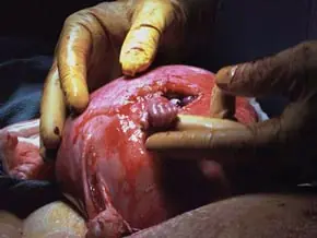 Historias asombrosas: Mano a mano