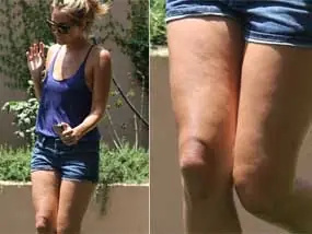 Las celebridades no son perfectas