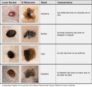 Cancer de Piel ( muy importante informate, prevenite!!)