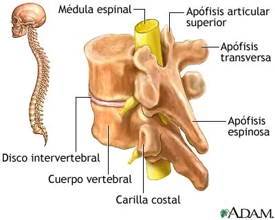 Traumatismo de medula espinal.