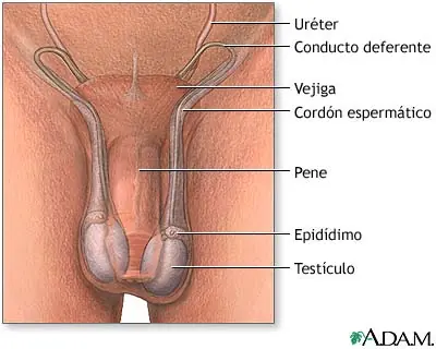 Torsion testicular.