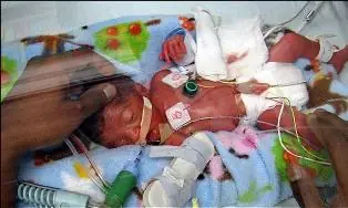 Milagro: Dió a luz una mujer con muerte cerebral