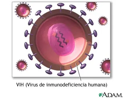 Infección por VIH asintomática