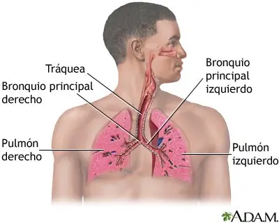 Asma ocupacional