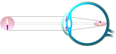 el ojo humano, caracteristica, y defectos