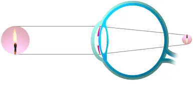 ojo