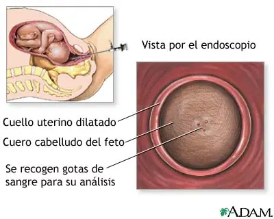 Examen de sangre fetal