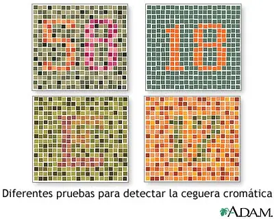 Examen de visión cromática