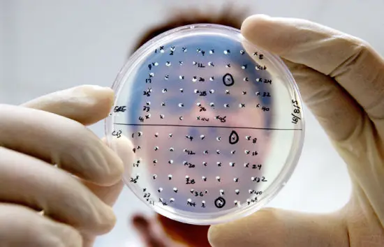 Ya esta lista la formula contra el virus H1N1