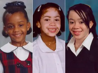 Desiree Simmons y el Vitiligo