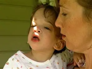 El extraño caso de la niña que no envejece