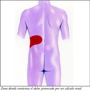 Poca-Bola a la Coca-Cola