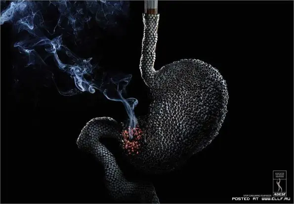 Fumas?, Si miras aca vas a dudar Seguir Fumando!