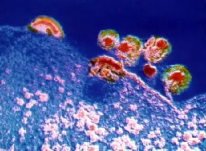 [Megapost Sobre El VIH--SIDA]