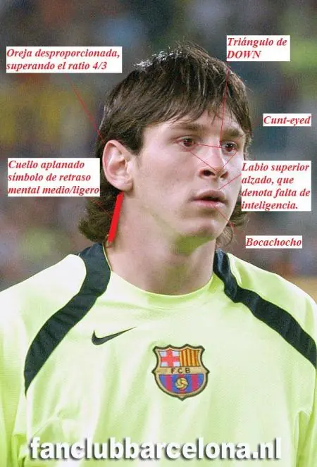 Es Messi retrasado ?