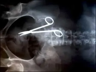 radiografias extrañas