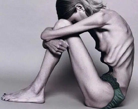 Anorexia, Para tomar conciencia.