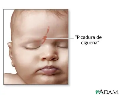Marca de la cigüeña.