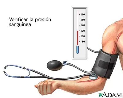 presion arterial baja
