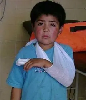 Niño Mapuche, torturado baleado, y acusado de terrorista