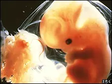 Crean embriones con ADN de 2 mujeres.