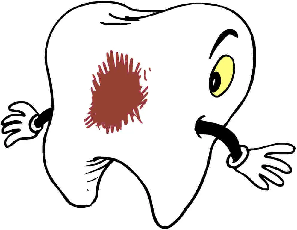 Tu peor enemigo la caries