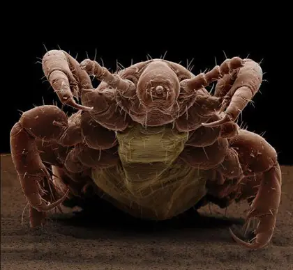 Descifraron el genoma del piojo