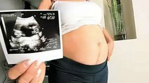 Mujer de 50 años dará a luz a su 'nieto'