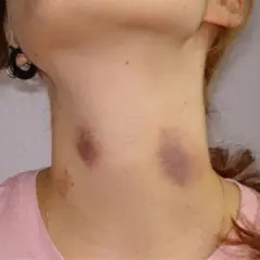 besos