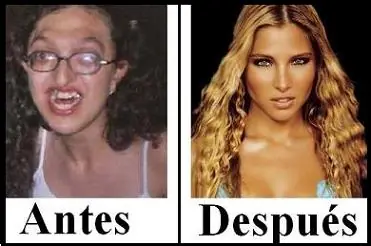 buitre