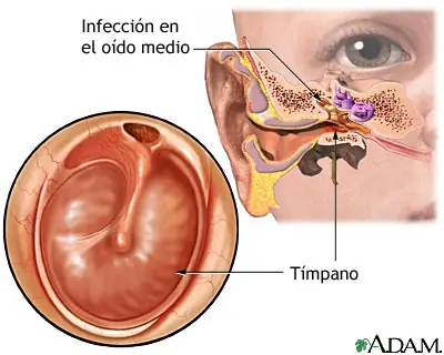 Te Duele el Oido?