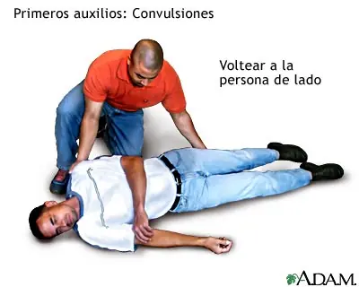 Convulsiones: Primeros Auxilios
