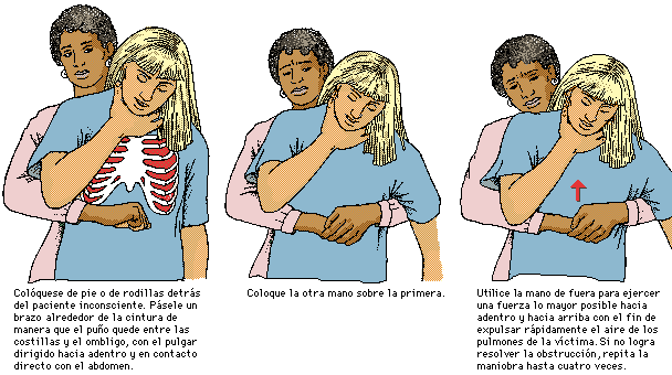 SOS. Maniobra de Heimlich