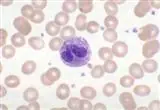 hemograma