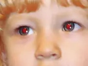 ¿Por que los ojos rojos en las fotografías?