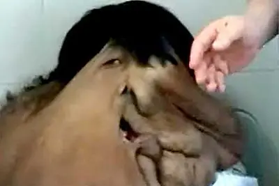El Hombre Elefante..videos...imagenes