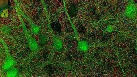 Nuestro cerebro bien de cerca!