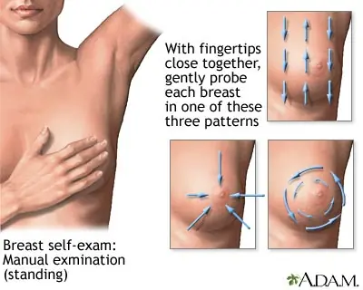 Cómo prevenir el cáncer