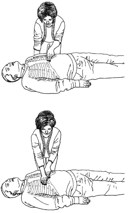 Resucitación Cardiopulmonar...Primeros Auxilios