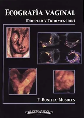 Ecografia Vaginal - (Doppler y 3D) - Bonilla