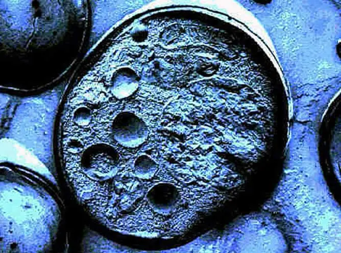 Primer ensayo para tratar la Esclerosis Multiple