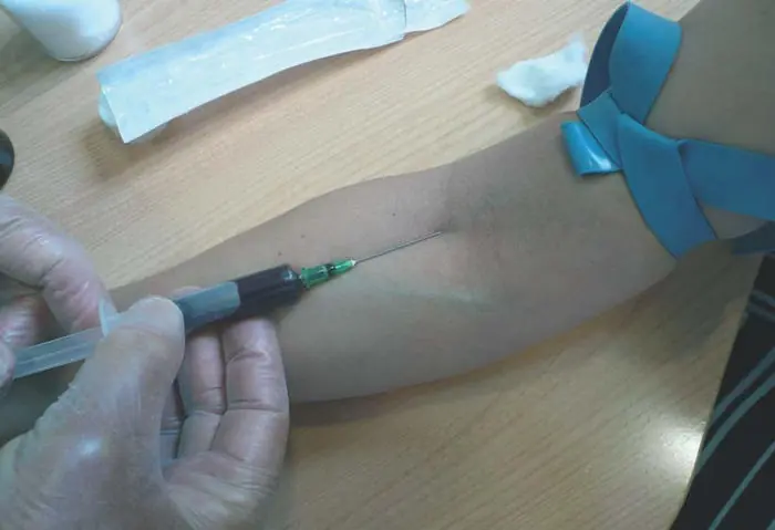 Como hacer una extracción sanguínea