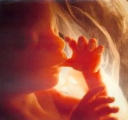 ¿Por qué no abortar?