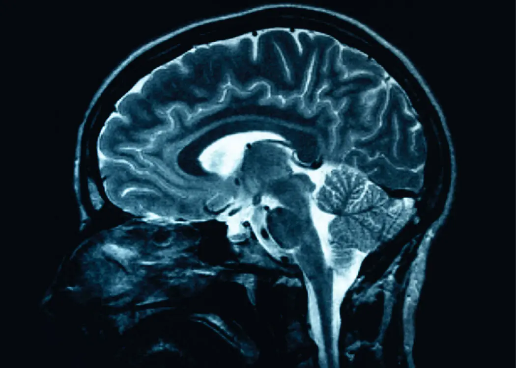 cerebro cerebro