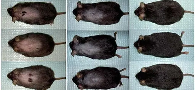 Buenas noticias para los pelado! Una cura!